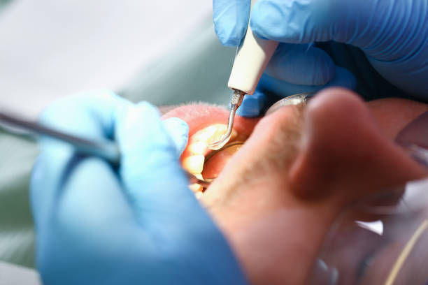 Best Cosmetic Emergency Dentistry in St Joseph, MO