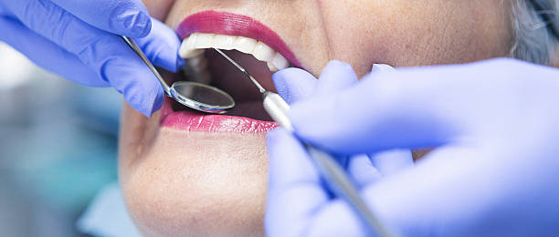 Best Emergency Treatment for Dental Infections or Abscesses in St Joseph, MO